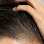scalp detox