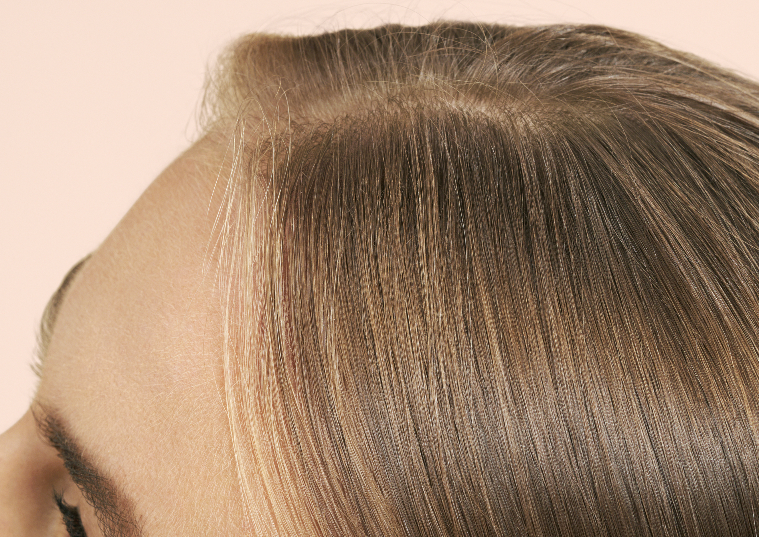 How to Stop Hair Loss in Women: TE Hair Loss Tips | Prose Hair