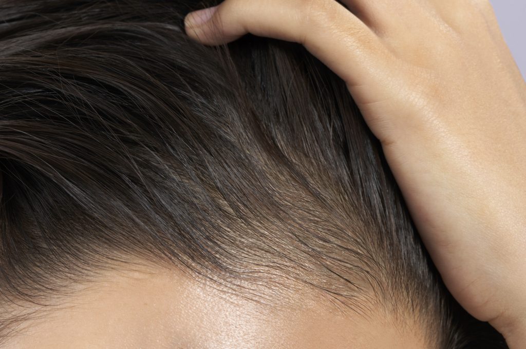 7 Signs/Symptoms of Heat-Damaged Hair & How to Revive It