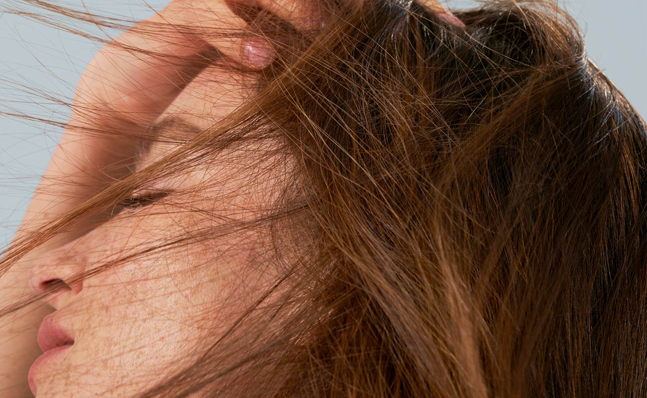 How Stress Can Cause Hair Loss |