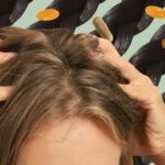 collage of woman rubbing her scalp with hair supplements in the background