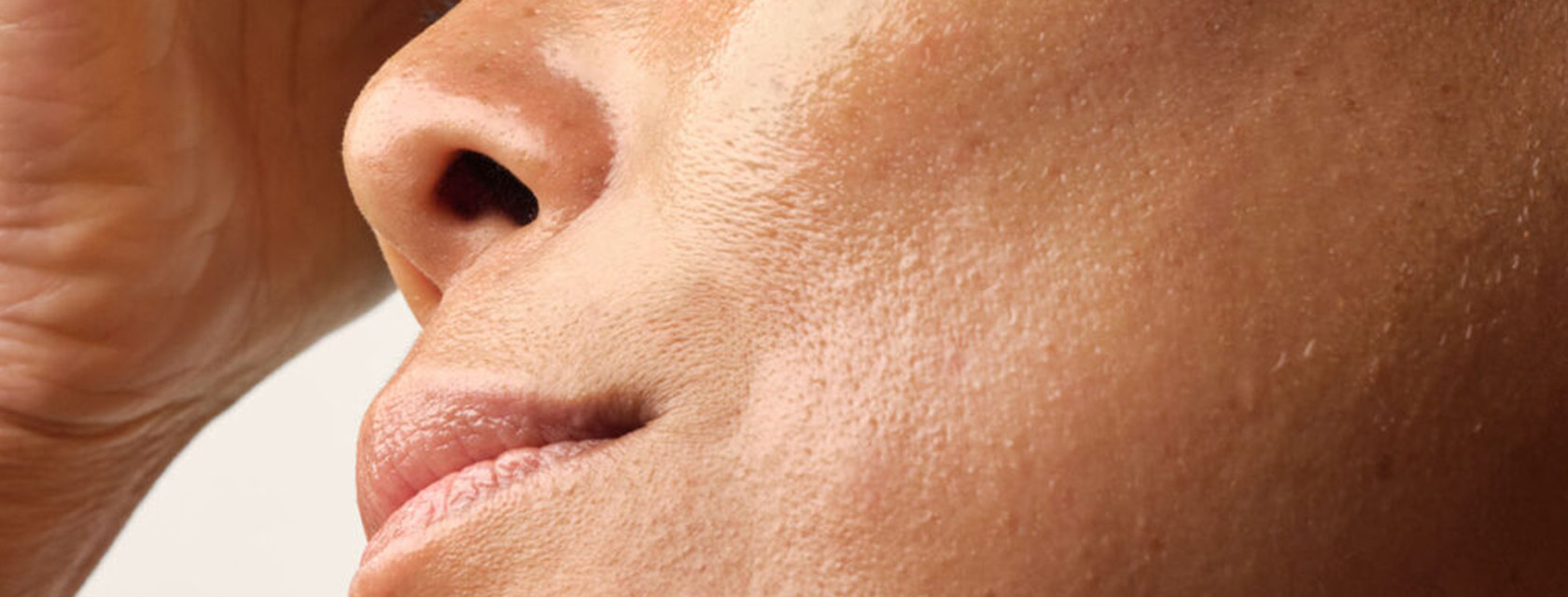 Causes of Textured Skin & How to Get Rid of It