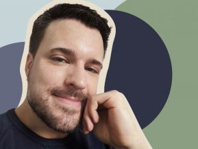 hair-transplant-before-and-after